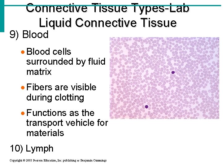 Connective Tissue Types-Lab Liquid Connective Tissue 9) Blood · Blood cells surrounded by fluid