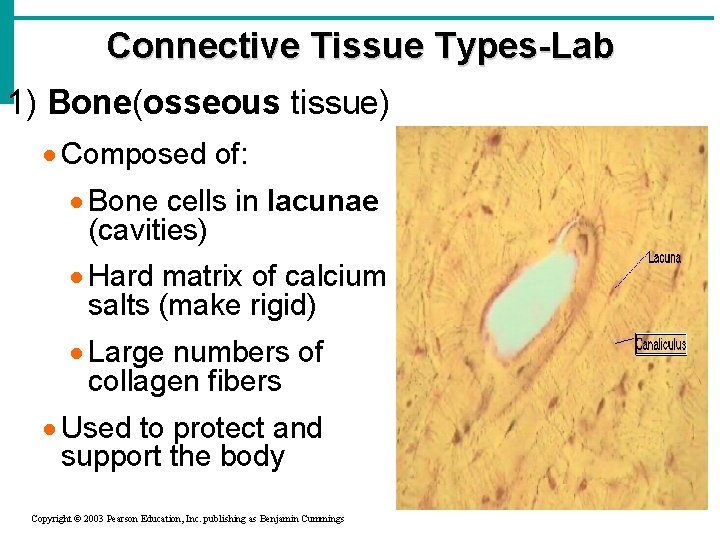 Connective Tissue Types-Lab 1) Bone(osseous tissue) · Composed of: · Bone cells in lacunae