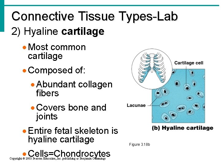 Connective Tissue Types-Lab 2) Hyaline cartilage · Most common cartilage · Composed of: ·