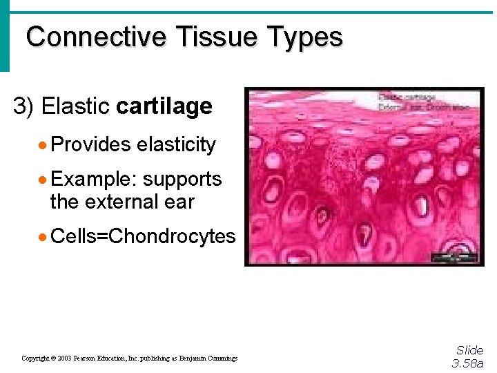 Connective Tissue Types 3) Elastic cartilage · Provides elasticity · Example: supports the external