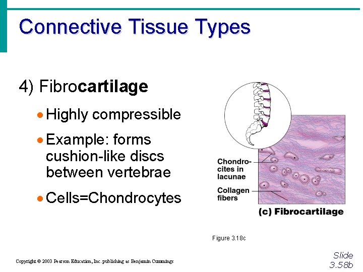 Connective Tissue Types 4) Fibrocartilage · Highly compressible · Example: forms cushion-like discs between