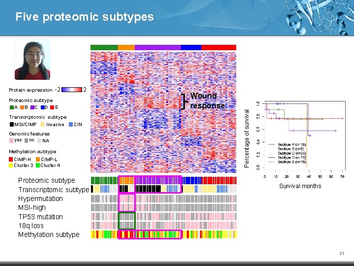 Protein expression -2 2 Proteomic subtype A B C D E Transcriptomic subtype MSI/CIMP