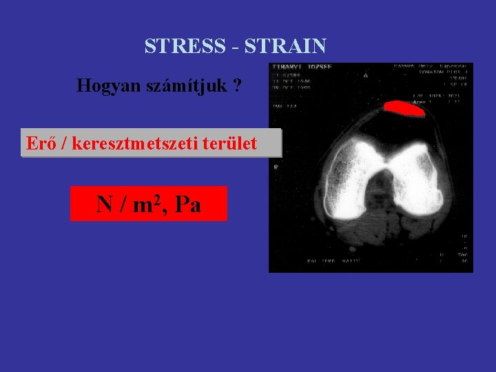 STRESS - STRAIN Hogyan számítjuk ? Erő / keresztmetszeti terület N / m 2,