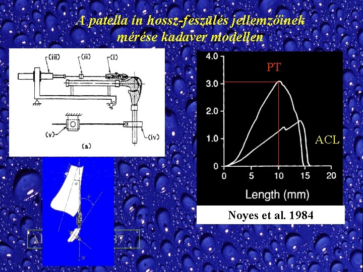 A patella ín hossz-feszülés jellemzőinek mérése kadaver modellen PT ACL Noyes et al. 1984