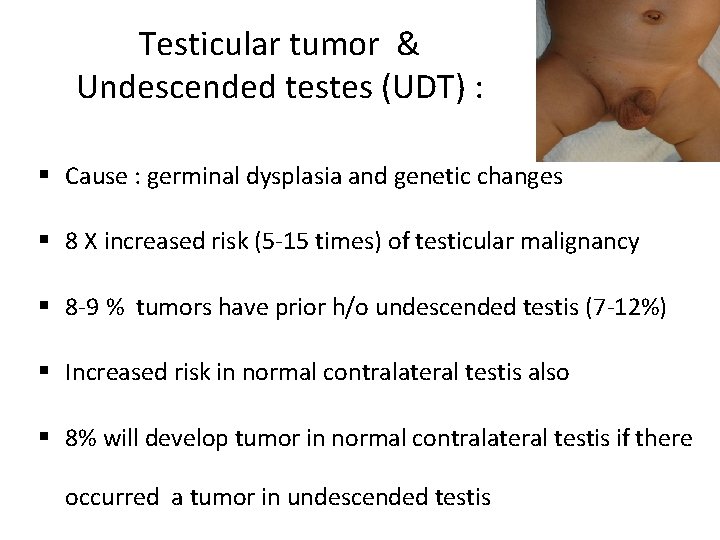 Testicular tumor & Undescended testes (UDT) : § Cause : germinal dysplasia and genetic