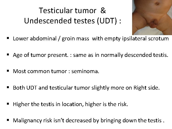 Testicular tumor & Undescended testes (UDT) : § Lower abdominal / groin mass with