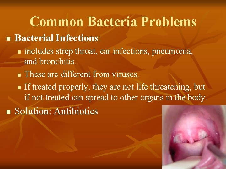 Common Bacteria Problems n Bacterial Infections: n n includes strep throat, ear infections, pneumonia,