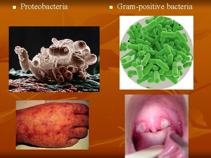 n Proteobacteria n Gram-positive bacteria 