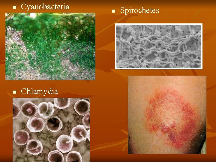 n Cyanobacteria n Chlamydia n Spirochetes 