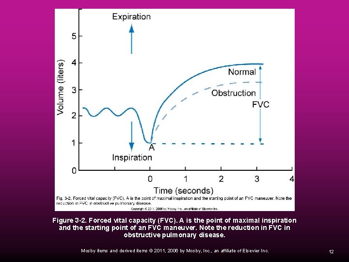 Figure 3 -2. Forced vital capacity (FVC). A is the point of maximal inspiration