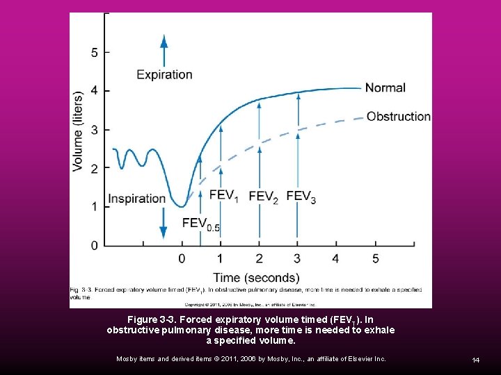 Figure 3 -3. Forced expiratory volume timed (FEVT). In obstructive pulmonary disease, more time