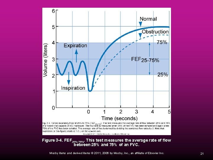 Figure 3 -4. FEF 25%-75%. This test measures the average rate of flow between