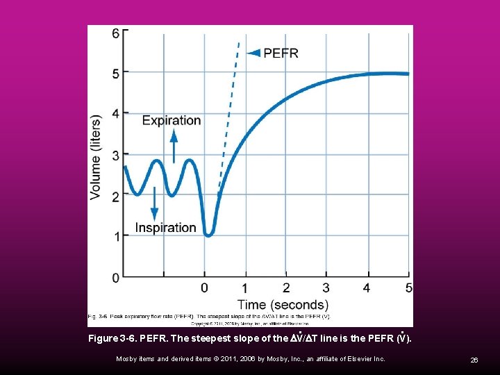 ˙ ˙ Figure 3 -6. PEFR. The steepest slope of the DV/DT line is