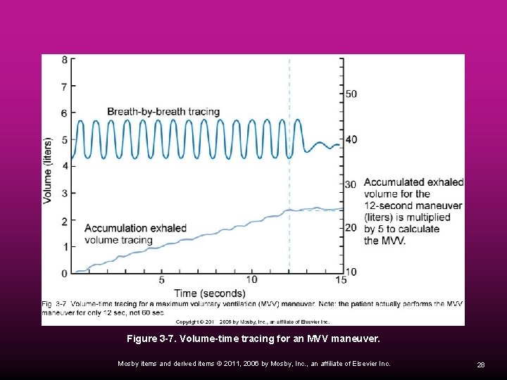 Figure 3 -7. Volume-time tracing for an MVV maneuver. Mosby items and derived items