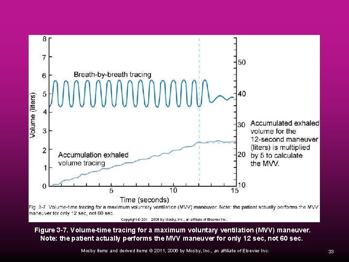 Figure 3 -7. Volume-time tracing for a maximum voluntary ventilation (MVV) maneuver. Note: the