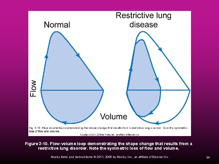 Figure 3 -10. Flow-volume loop demonstrating the shape change that results from a restrictive
