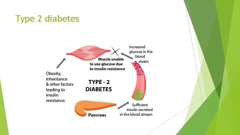 Type 2 diabetes 