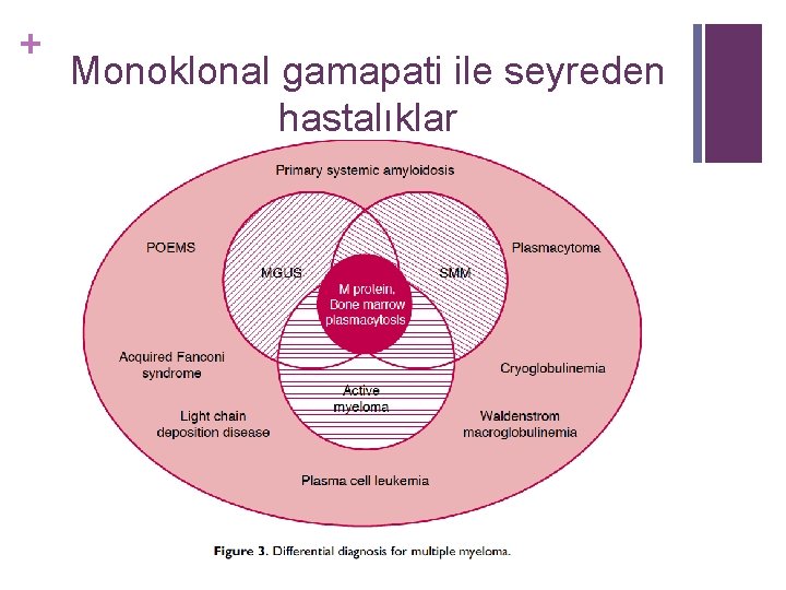 + Monoklonal gamapati ile seyreden hastalıklar 