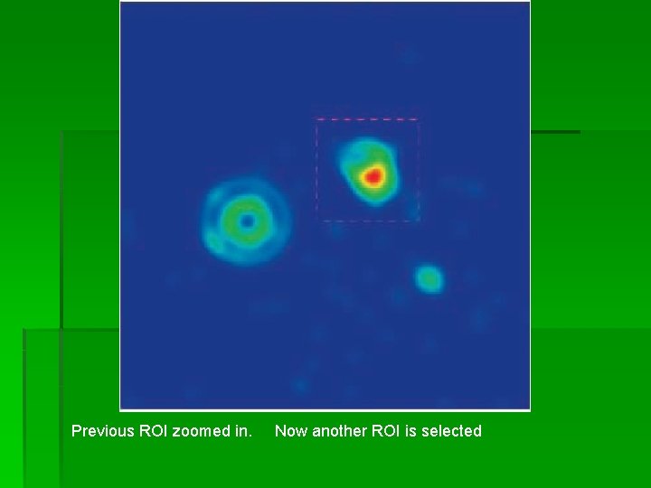 Previous ROI zoomed in. Now another ROI is selected Previous ROI zoomed in. Now another ROI is selected