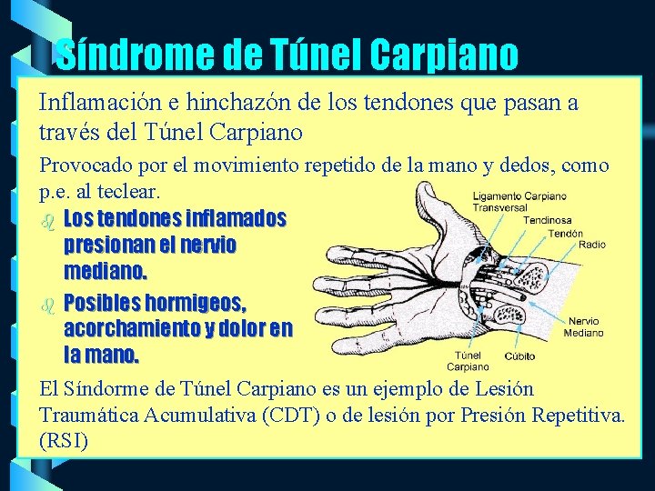 Síndrome de Túnel Carpiano Inflamación e hinchazón de los tendones que pasan a través