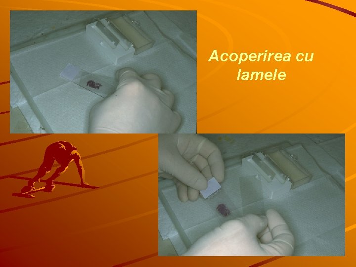 Acoperirea cu lamele 