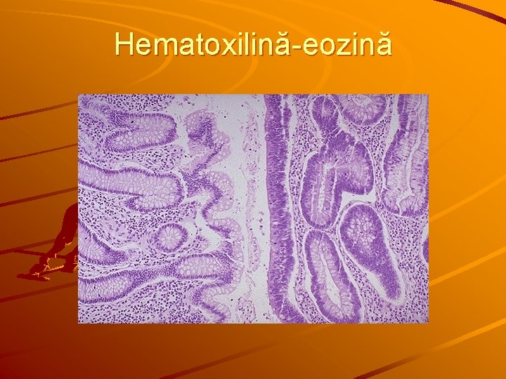 Hematoxilină-eozină 