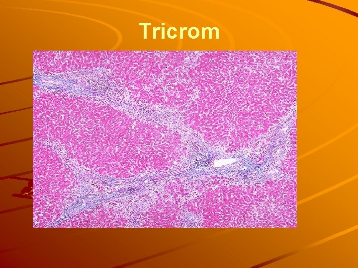 Tricrom 