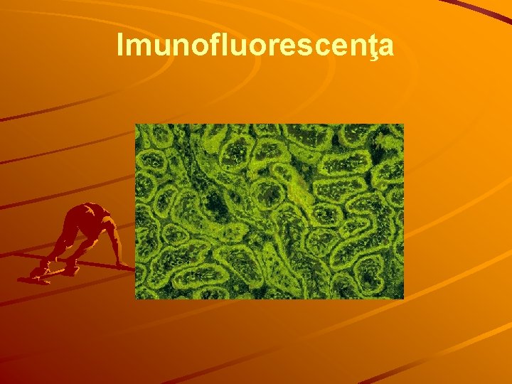 Imunofluorescenţa 