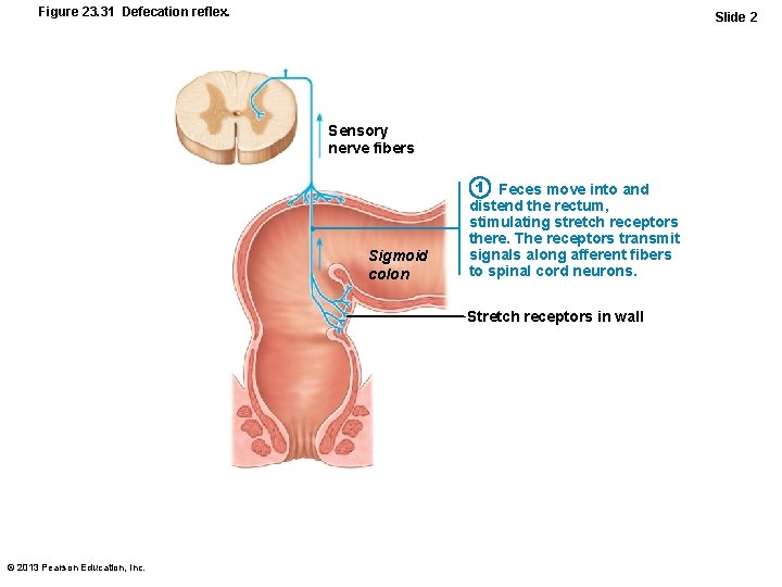 Figure 23. 31 Defecation reflex. Slide 2 Sensory nerve fibers Sigmoid colon 1 Feces