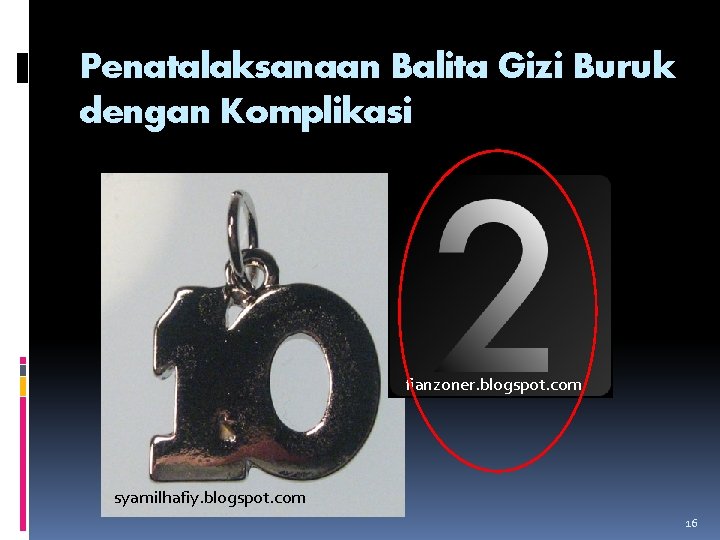 Penatalaksanaan Balita Gizi Buruk dengan Komplikasi fianzoner. blogspot. com syamilhafiy. blogspot. com 16 