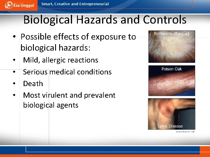 Biological Hazards and Controls • Possible effects of exposure to biological hazards: • •