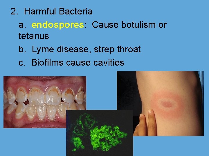 2. Harmful Bacteria a. endospores: Cause botulism or tetanus b. Lyme disease, strep throat