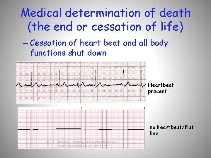 Medical determination of death (the end or cessation of life) – Cessation of heart