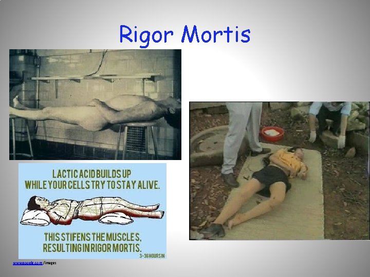 Rigor Mortis www. google. com /images 