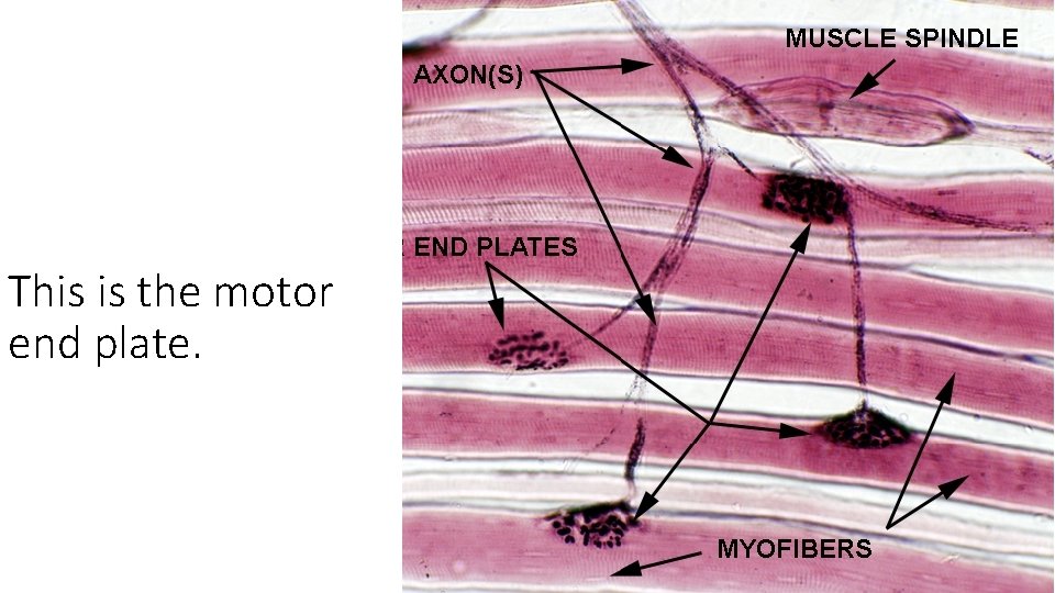 This is the motor end plate. 