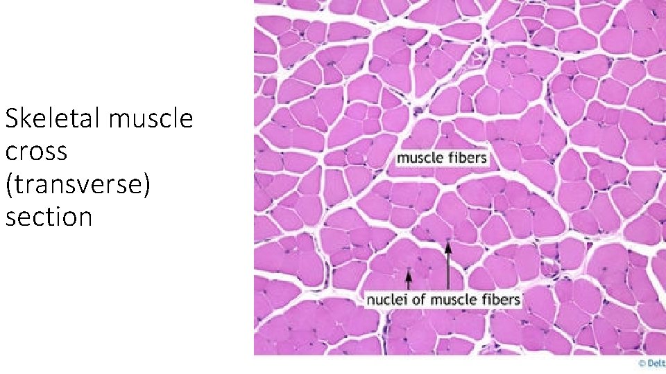 Skeletal muscle cross (transverse) section 