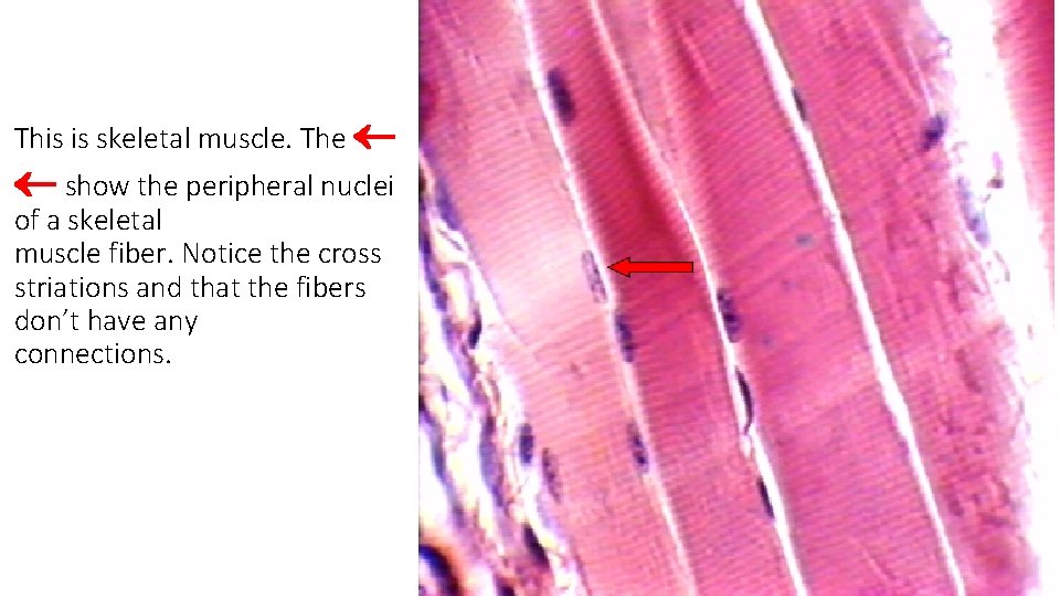 This is skeletal muscle. The show the peripheral nuclei of a skeletal muscle fiber.