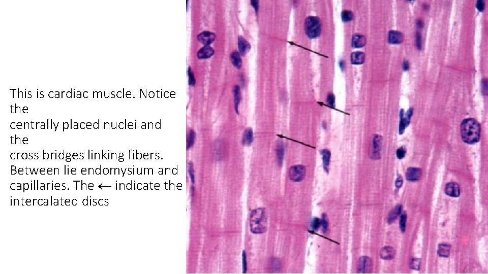 This is cardiac muscle. Notice the centrally placed nuclei and the cross bridges linking