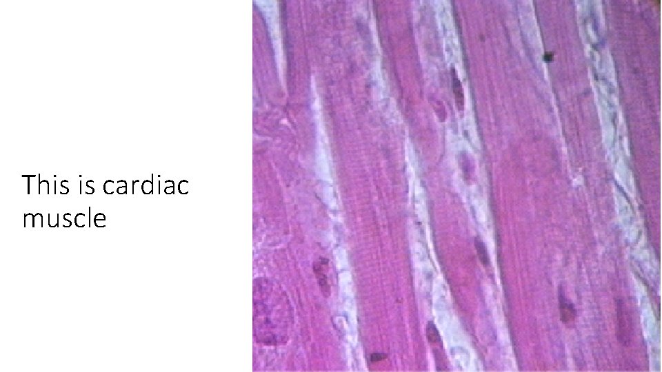 This is cardiac muscle 