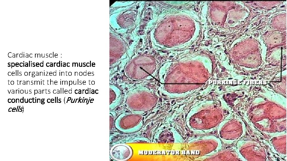Cardiac muscle : specialised cardiac muscle cells organized into nodes to transmit the impulse