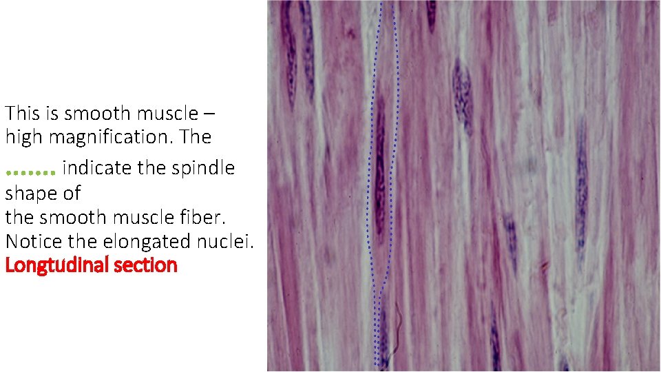 This is smooth muscle – high magnification. The. . . . indicate the spindle