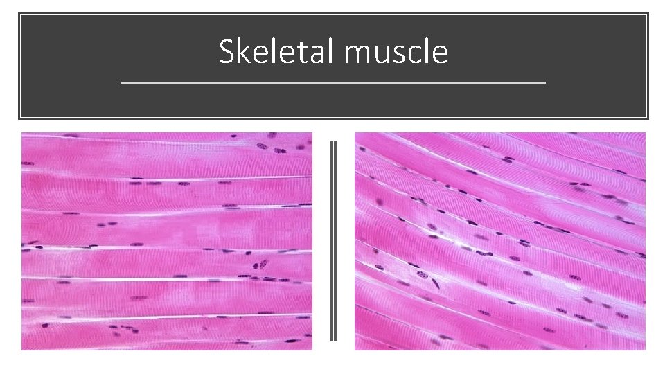 Skeletal muscle 