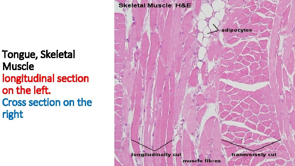 Tongue, Skeletal Muscle longitudinal section on the left. Cross section on the right 