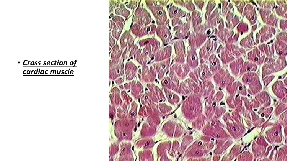  • Cross section of cardiac muscle 