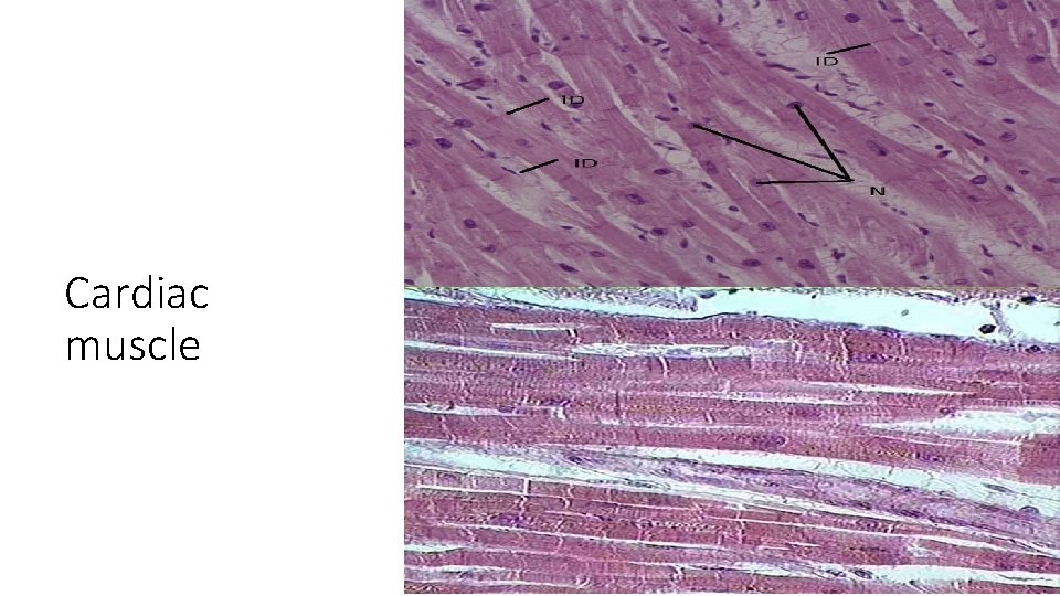 Cardiac muscle 