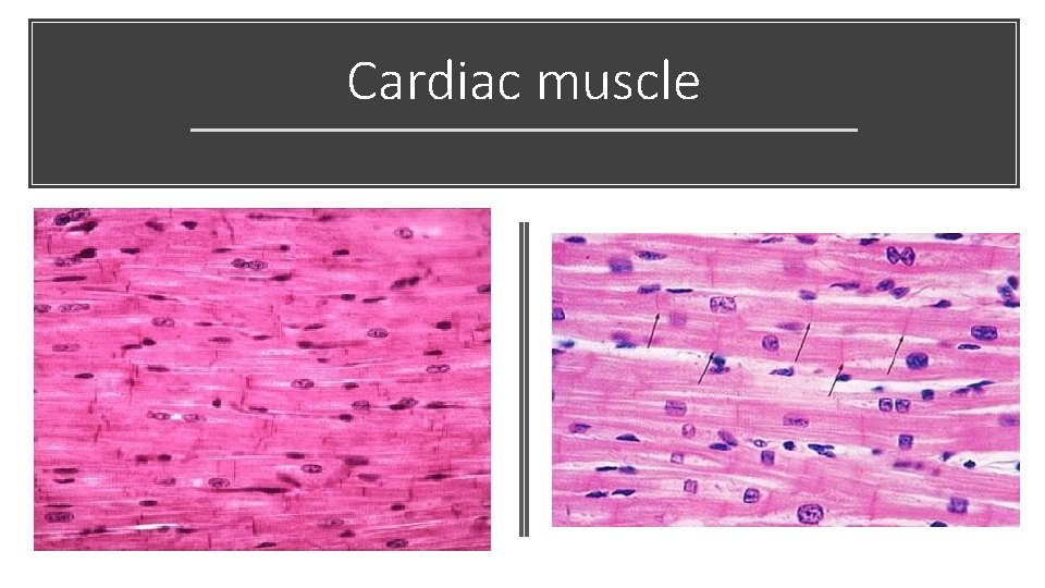 Cardiac muscle 
