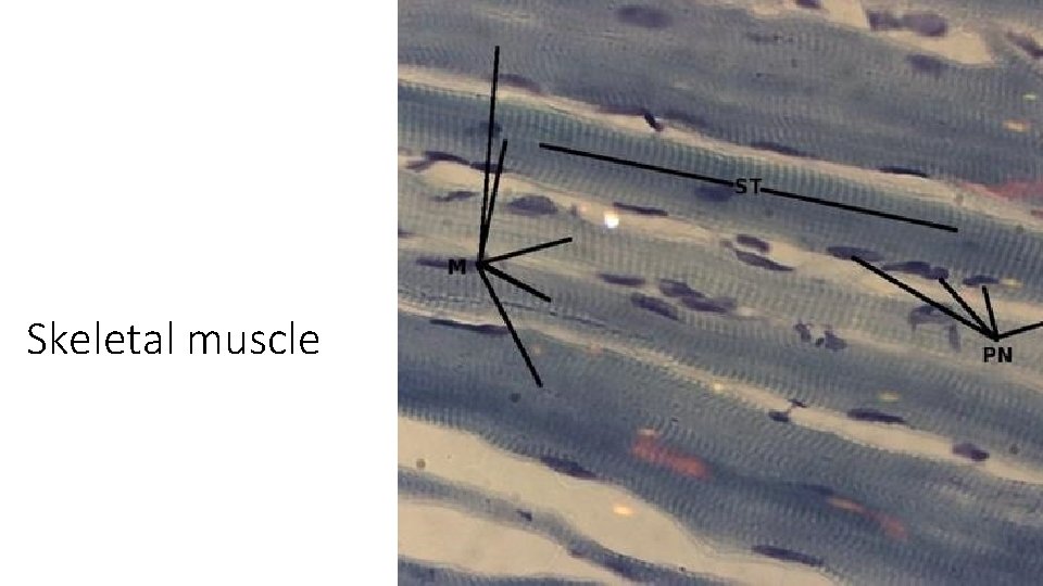 Skeletal muscle 