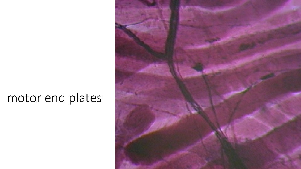 motor end plates 