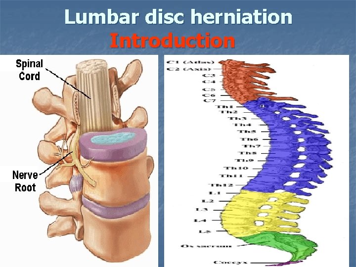 Lumbar disc herniation Introduction 
