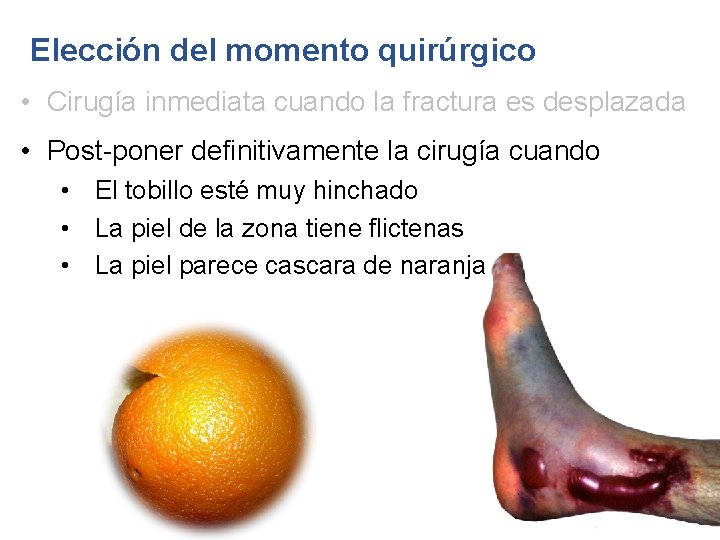 Elección del momento quirúrgico • Cirugía inmediata cuando la fractura es desplazada • Post-poner
